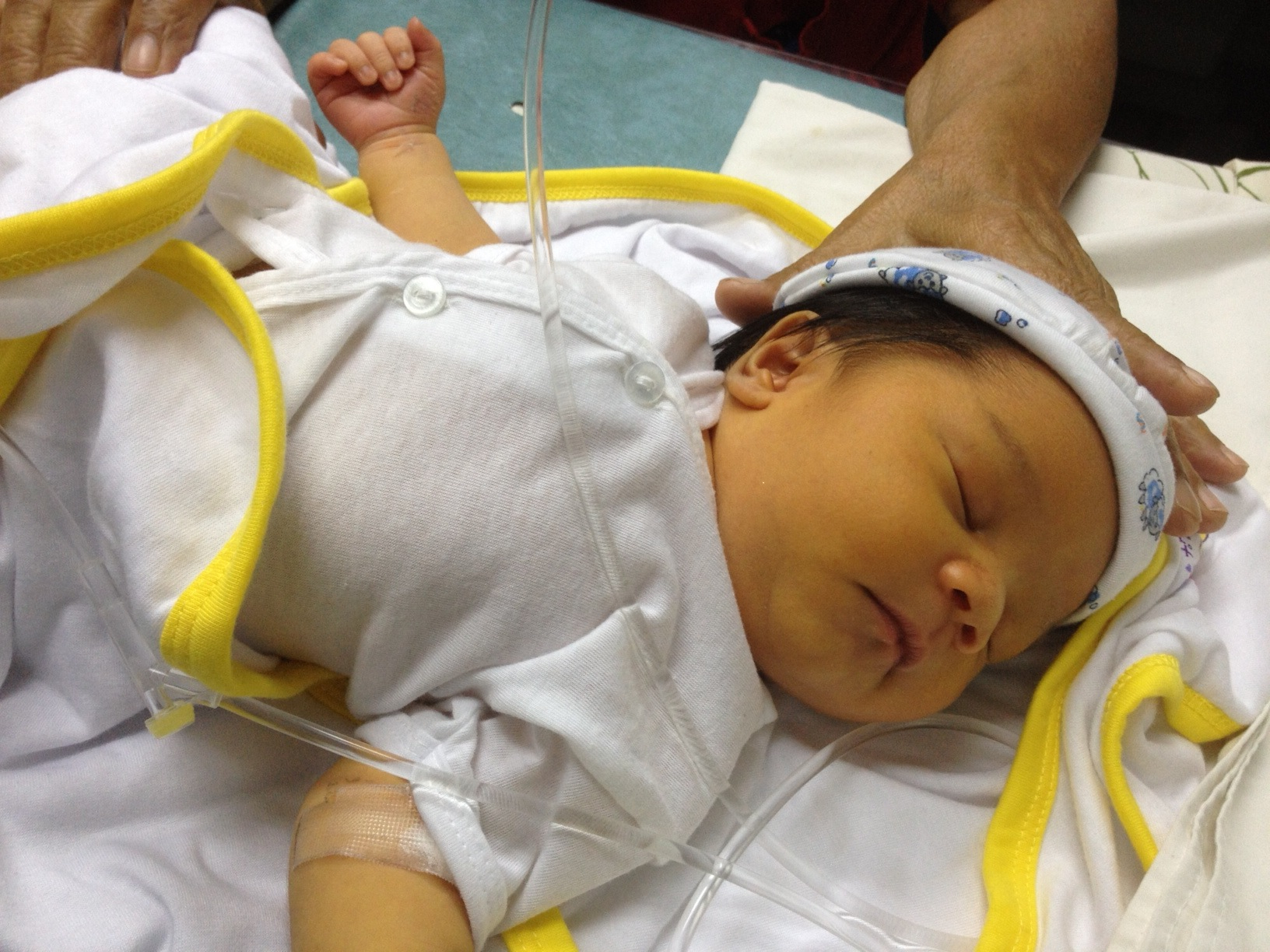 норма билирубина у новорожденных